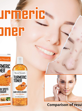 Black-removing turmeric toner deeply moisturizes, tightens a