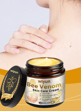 Bee venom to remove nevus skin care cream herbal mild desali