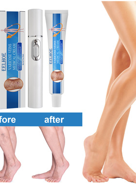 Vein Massage Ointment Soothes Vein Vein Massage Varicose Rel