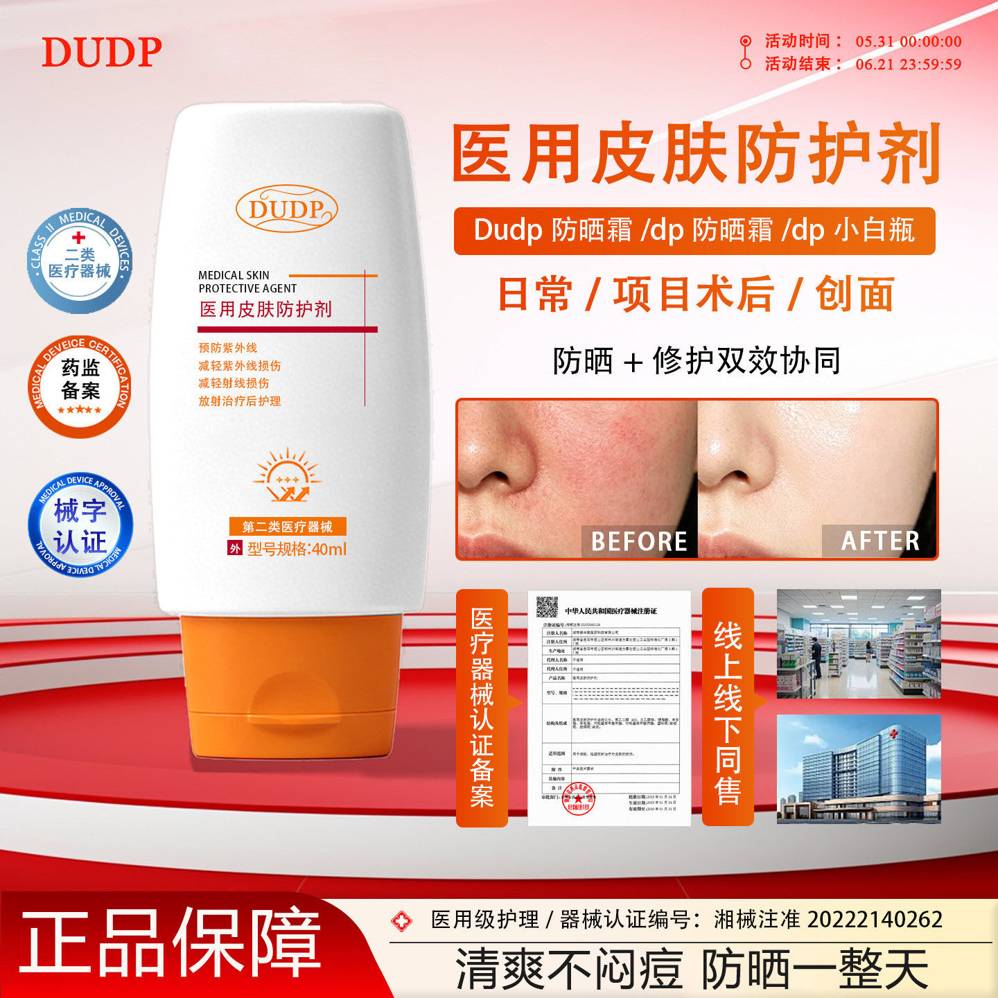 DUDP医用防晒霜激光微针术后敏感肌肤皮肤护理减轻紫外线预防损伤
