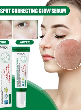 Blemish ReductionBrightening EssenceSkin RepairDull SkinPigm