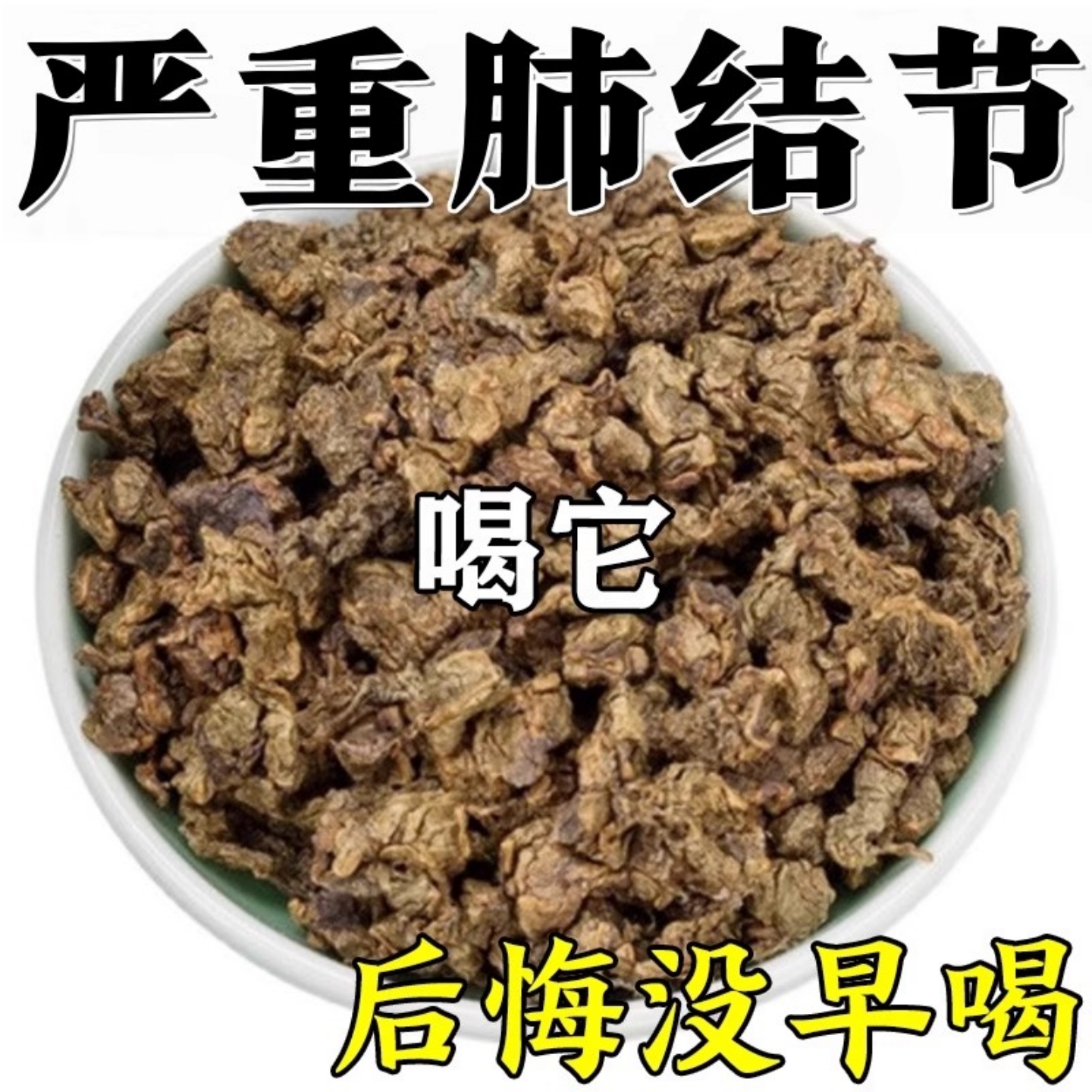 肺结节散结茶蒲公英消除止咳化痰润肺槲皮素清养肺部大清理中成药