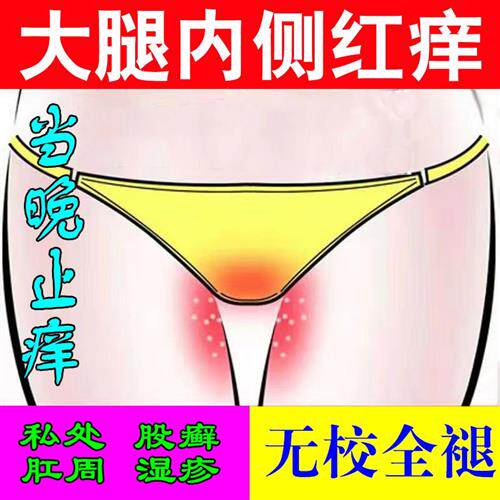 新品大腿摩擦f红肿烧裆膏胖人走路磨大腿防摩擦膏腿根部瘙痒起疙