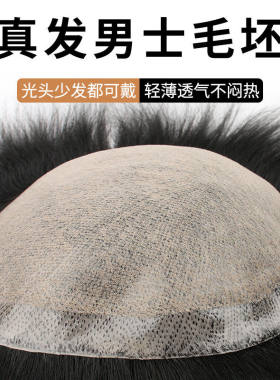 士假发片 仿递针真人发丝发块秃顶遮前额头顶补发 许昌