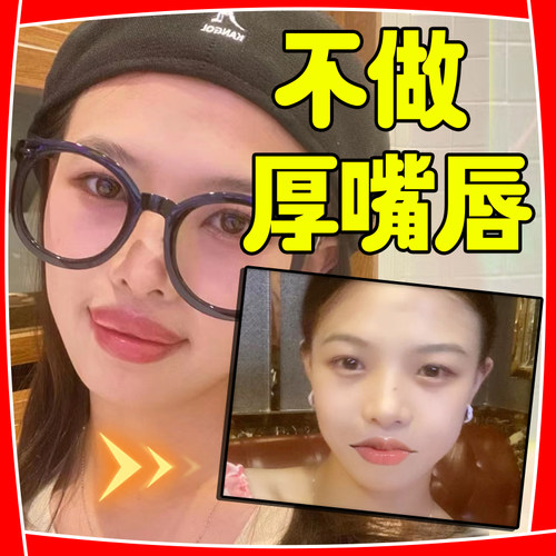 速发瘦唇膏嘴唇i变薄外翻矫正变小改善香肠嘴嘴唇紧绷增厚唇纹嘴