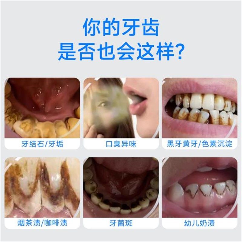 月儿弯弯洁牙器超声波洗牙器家用清牙齿黄黑美牙仪冲去除烟渍牙垢,生活电器,超声波迷你清洗机,淘宝优惠券,粉丝福利购,淘宝优惠卷