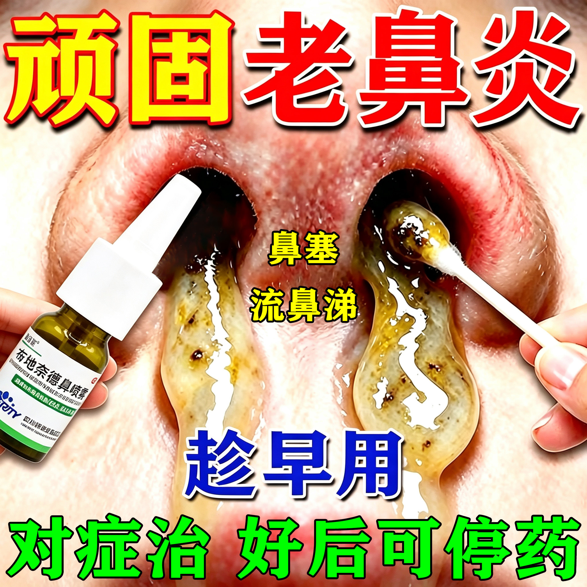 [普舒顺]布地奈德鼻喷雾剂120喷*1瓶/盒