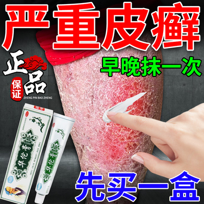 【科田】华佗膏20g*1支/盒