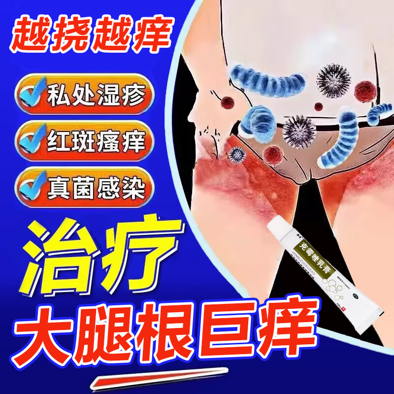 大腿根内侧瘙痒潮湿去股藓湿疹真菌感染男性私处瘙痒止痒专用药膏