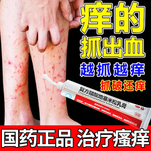 皮炎用药神经性皮炎外用膏治皮肤瘙痒湿疹止痒药过敏瘙痒症药膏