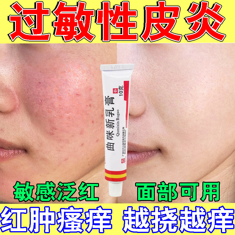 脸部过敏专用药过敏性皮炎药膏皮肤红肿干燥瘙痒湿疹止痒膏春敏