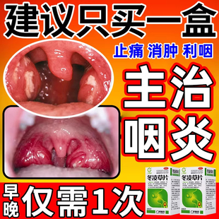 冬凌草片100片治咽喉炎慢性咽炎专用嗓子干痒有异物特感效药卡痰