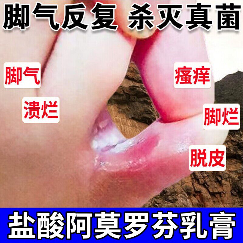 盐酸阿莫罗芬乳膏脚气烂脚丫药糜烂脚趾止痒脱皮杀菌真菌感染专用