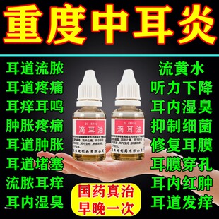 中耳炎专用药滴耳液耳朵发炎流脓黄水可除痒根止痒抑菌消炎滴耳油