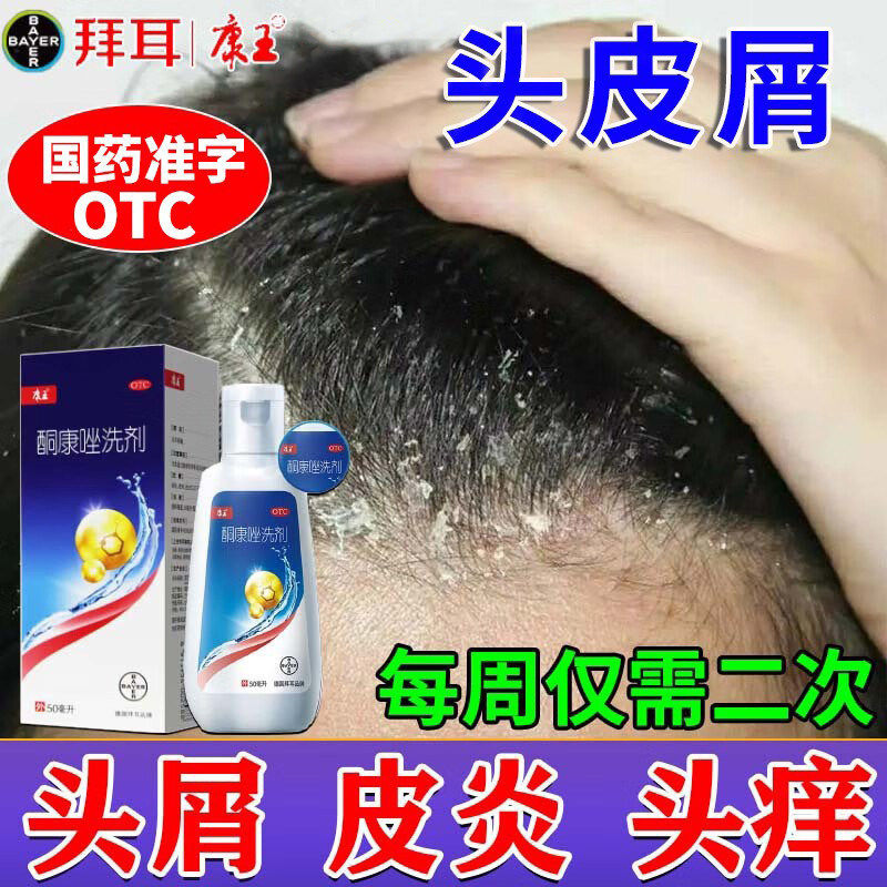 康王酮康唑发用洗剂正品洗发水洗头膏毛囊炎头皮屑去屑止痒医用药