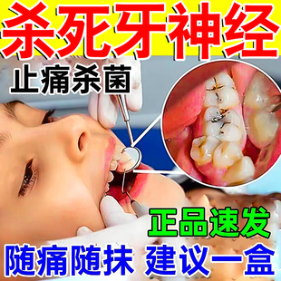 牙痛牙疼止疼药速消炎止痛效牙龈肿痛萎缩特专用药水牙疼止疼喷雾