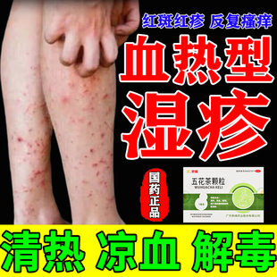 五花茶颗粒血热湿疹皮肤痒湿疹止痒去它根血热凉血茶解毒清热