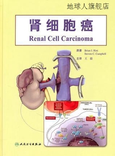 肾细胞癌,王毅编著,人民卫生出版社,9787117134491