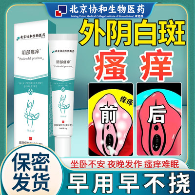 外阴白斑止痒黄体酮正品