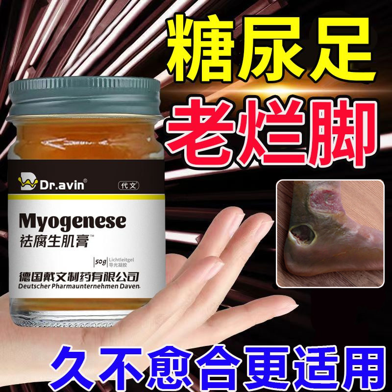 【糖尿足老烂脚】足部发黑溃烂窟窿疼痛化脓乳膏皮肤护理kj