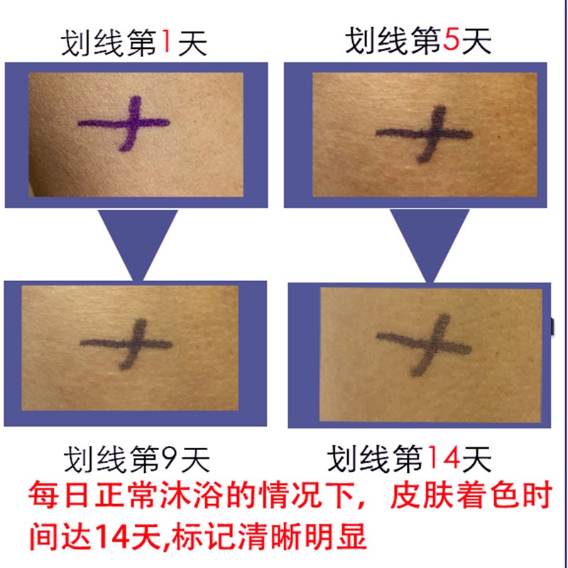顺丰航空包邮普赛士放疗定v位记号笔长效皮肤笔防水防汗不晕染人图片
