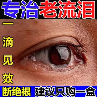 迎风流泪滴眼液泪道堵塞眼药水治疗眼睛流眼泪经常干涩疲劳模糊花