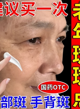 维a酸乳胶膏治疗老年斑专用药祛医用斑药膏官方旗舰店淡化黑色素