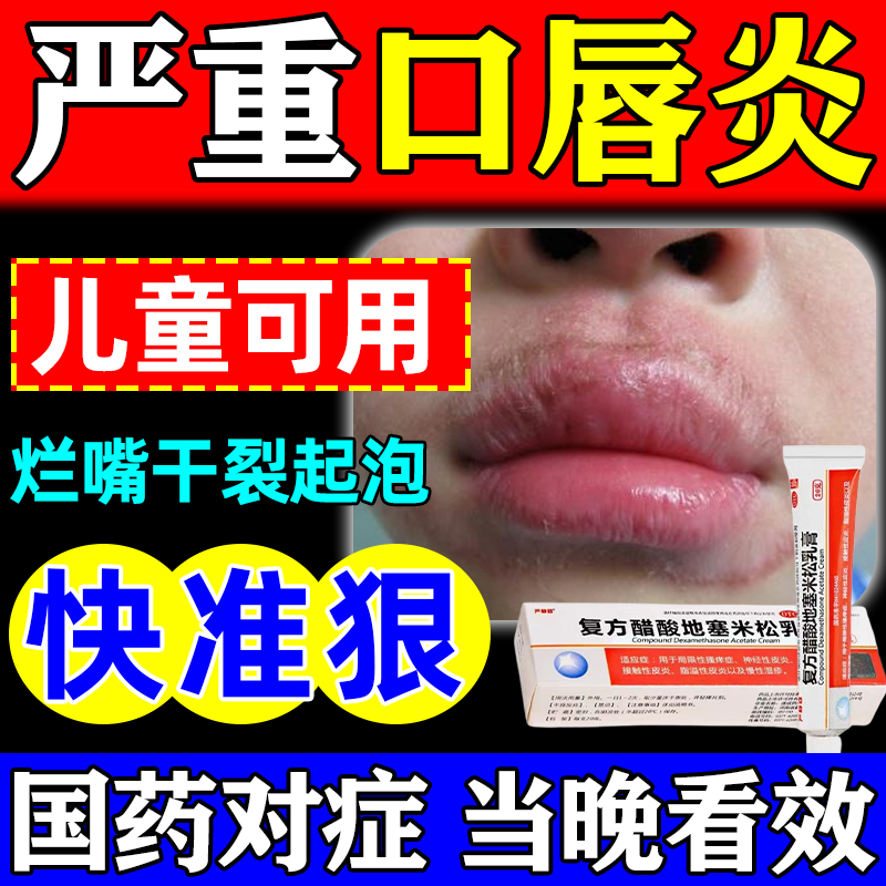 【太平洋】复方醋酸地塞米松乳膏20g*1瓶/盒
