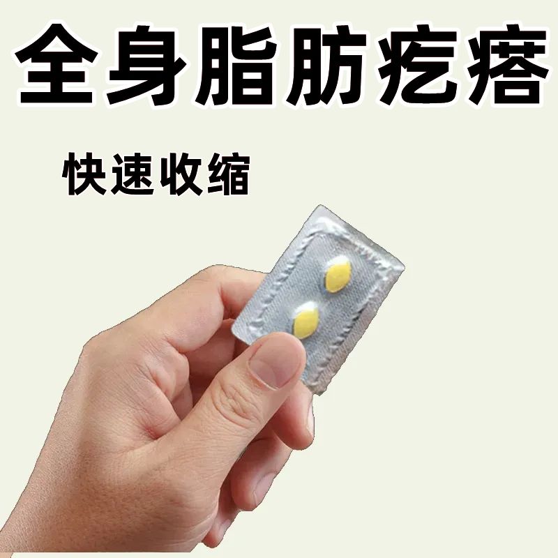 【脂肪康片24片】脂肪硬块全身皮下疙瘩纤维单/多发性家用