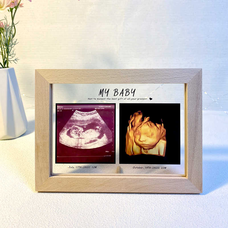 透明感婴幼儿新生宝宝孕期b超亚克力实木相框四维彩超满月周岁礼