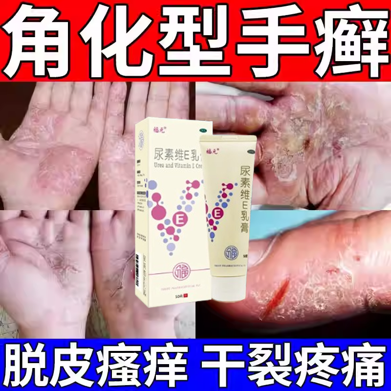 【福元】尿素维E乳膏15%*50g*1支/盒