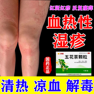 五花茶颗粒正品血热性湿疹皮肤瘙痒红斑红疹清热凉血解毒清热止痒