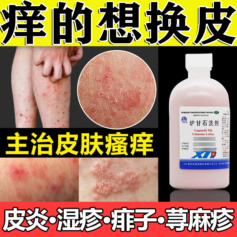 【信龙】炉甘石洗剂100ml*1瓶/盒