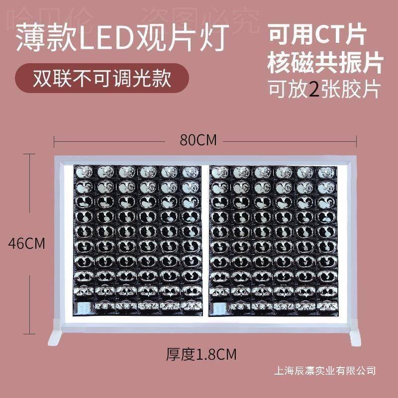 灯箱观片ct光板口腔灯核磁共振x片灯片医院led器材阅片片看片光机
