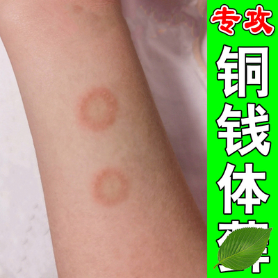 体鲜专用去铜钱鲜软膏身上皮肤泛红外用皮屑猫鲜