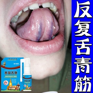 舌下青筋黑紫血管堵塞血液不流通舌头底血管怒张气血虚弱溶栓喷剂
