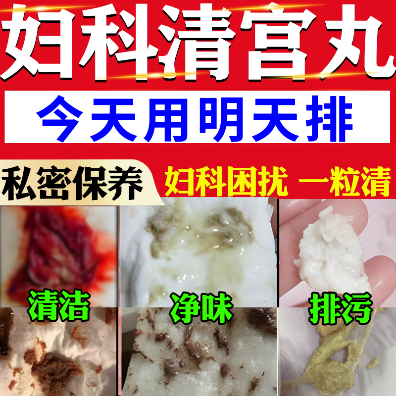 清宫丸中药排毒正品阴道炎子宫排脏污私密抑菌止痒祛味妇科拉线丸