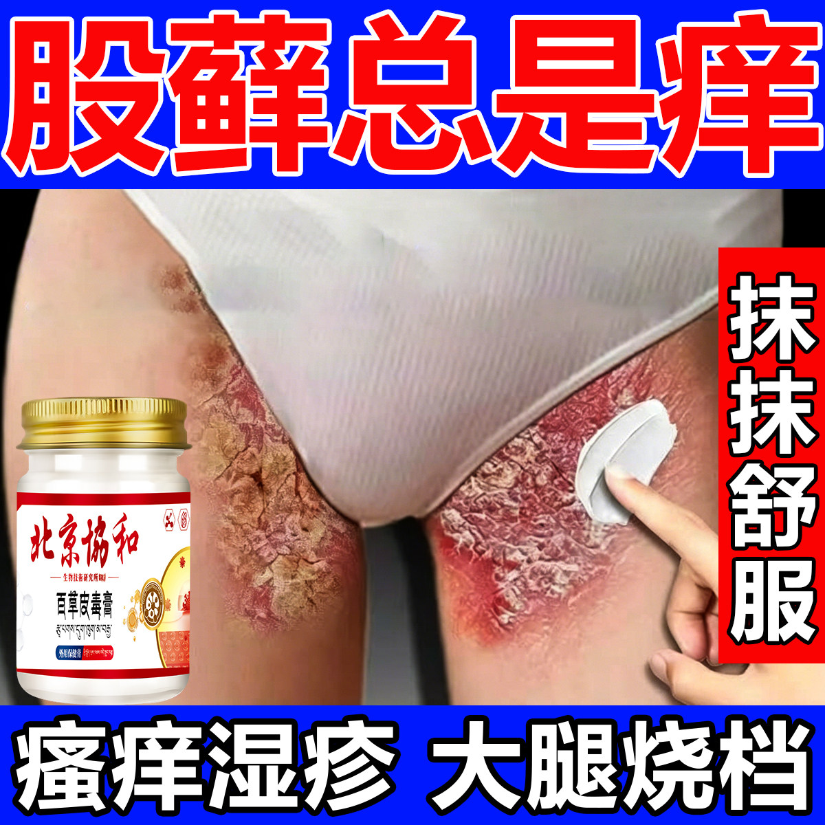 股癣专用大腿内侧皮肤瘙腹沟股痒藓疹真菌感染阴囊潮湿红疹止痒膏