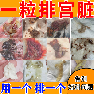 清宫丸中药排毒正品阴道炎子宫排脏污私密抑菌止痒祛味妇科拉线丸