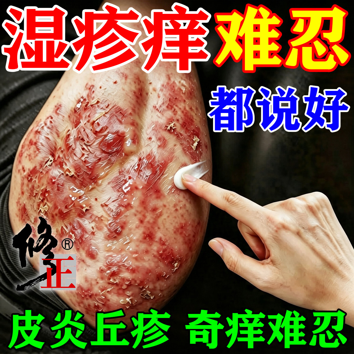 湿疹止痒专用慢性皮炎热毒角化型阴囊私处湿疹癣皮肤瘙痒抑菌软膏