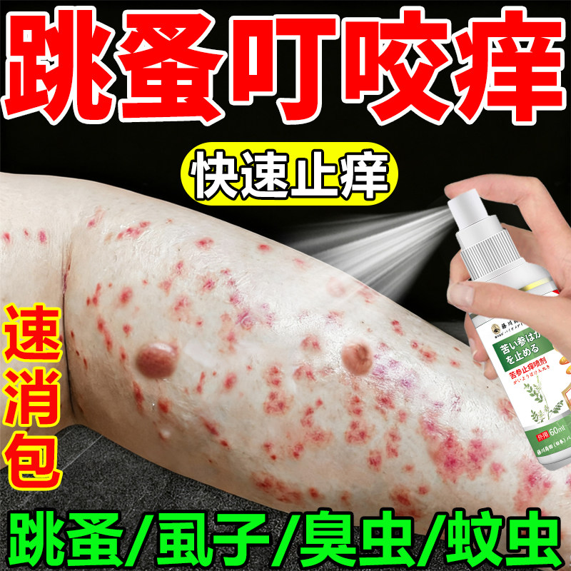 跳蚤咬用什么止痒膏瘙痒红肿专用虱子臭虫火红蚁叮咬消肿止痒喷雾