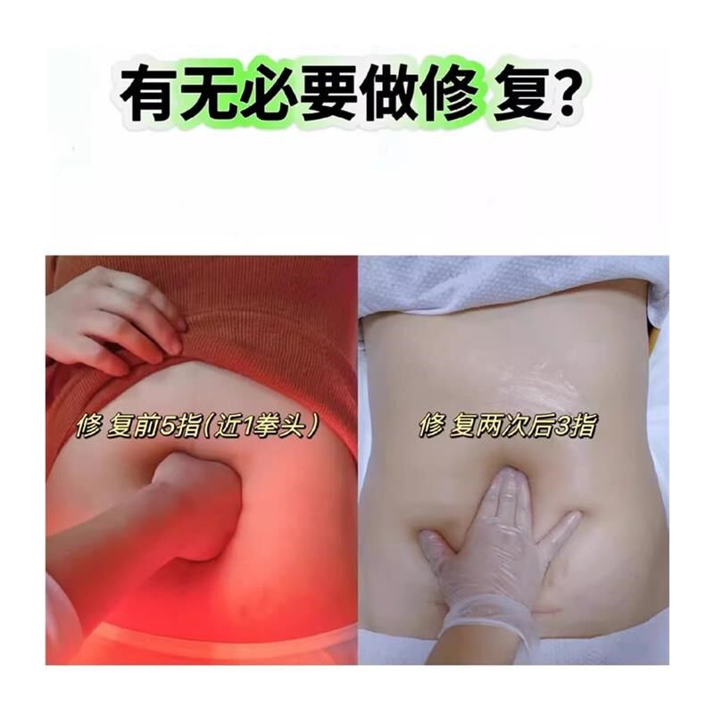 产后收腹训练仪家用腹部r直肌锻炼器肚子大松弛分离神器瘦恢修覆