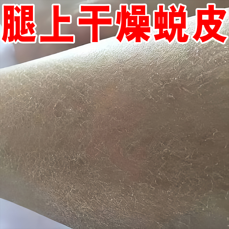 脸上额头起皮干燥脸干掉皮脸部起皮干痒皮屑起皮干皮护肤润甘油药