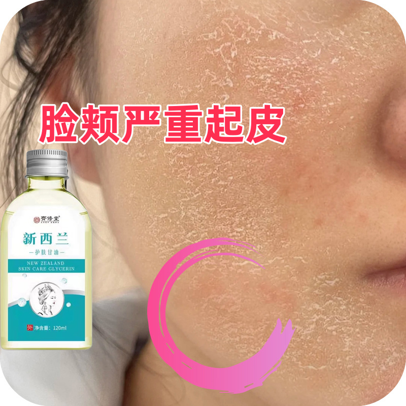 脸上起皮起皮面部脸上干痒脸上起皮干燥脸干掉皮脸部过敏脸痒去痒