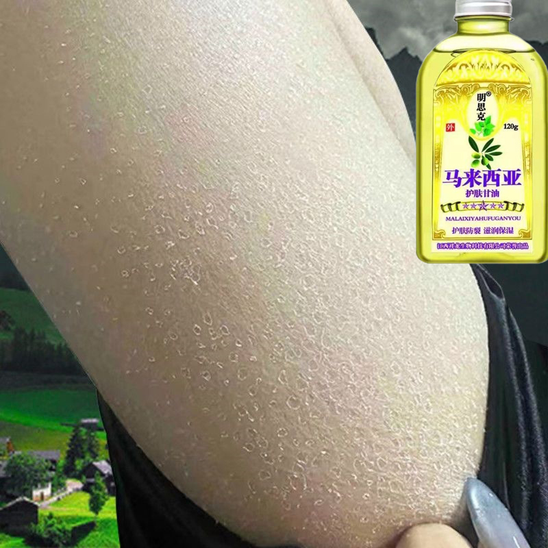 脸干燥起皮掉皮嘴角干燥起皮鼻子两侧起皮泛红掉皮干痒草本膏药乳