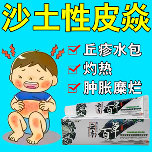 沙土性皮手腕手背密集丘疹水/泡皮肤粗糙痒增厚脱屑儿童专用膏