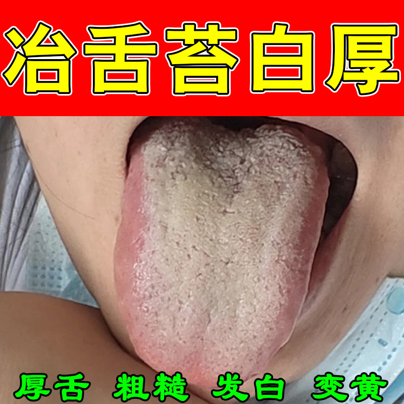 舌苔白厚舌头裂纹白腻发厚湿气重肝火盛齿舌调理去脾虚口气喷剂