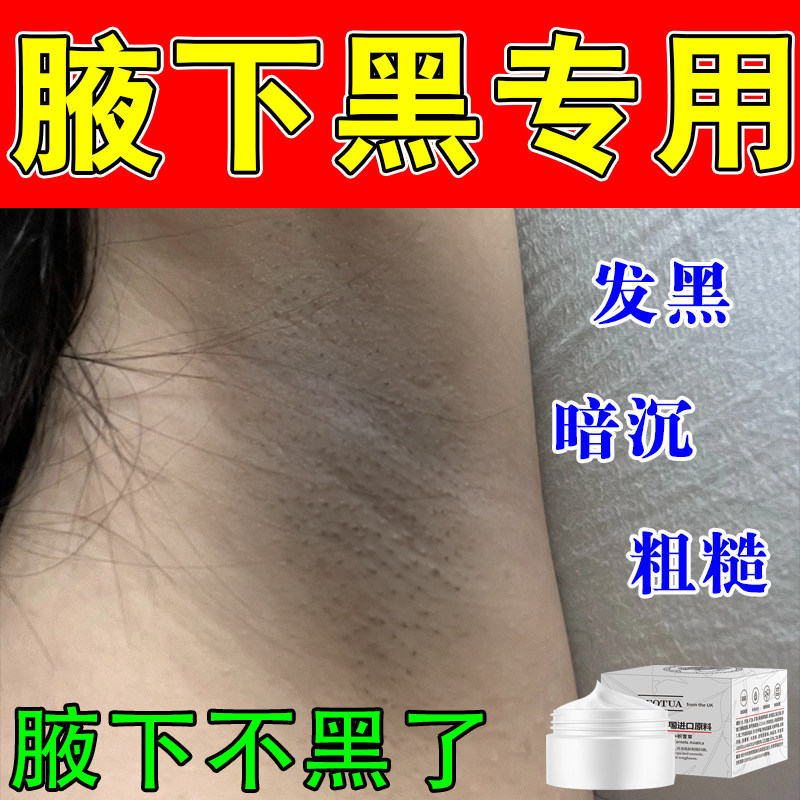 改善腋下暗沉发黑腋窝粗糙胳肢窝暗沉腋下褶皱色素堆积按摩膏