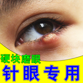 针眼眼药水眼睛红肿粒肿眼皮囊肿视物模糊眼睑板堵塞专用滴眼液