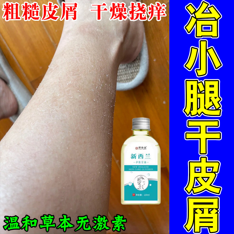 小腿干燥起皮屑痒腿上干燥粗糙皮屑白屑痒粗糙白皮修护保湿甘油